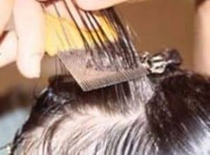 Head Lice 2